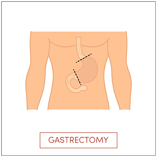 Cancer Surgery Clinic
