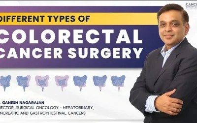 Colorectal Cancer Surgery: Types & Techniques – Dr. Ganesh Nagrajan