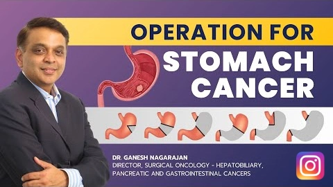 Cancer Surgery Clinic