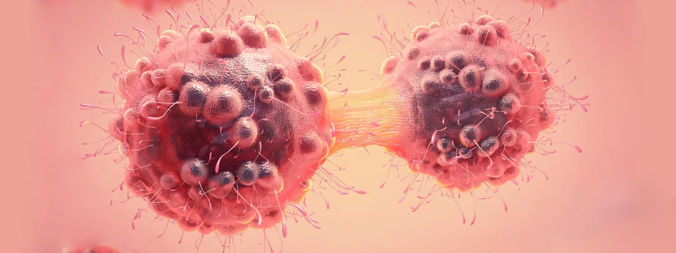 Right Cancer Treatment Decision in Mumbai